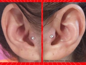Paired tragus ti          